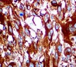 Melanoma Antibody (Ready-to-Use)