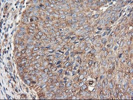 TUBAL3 Antibody (clone OTI4C5)