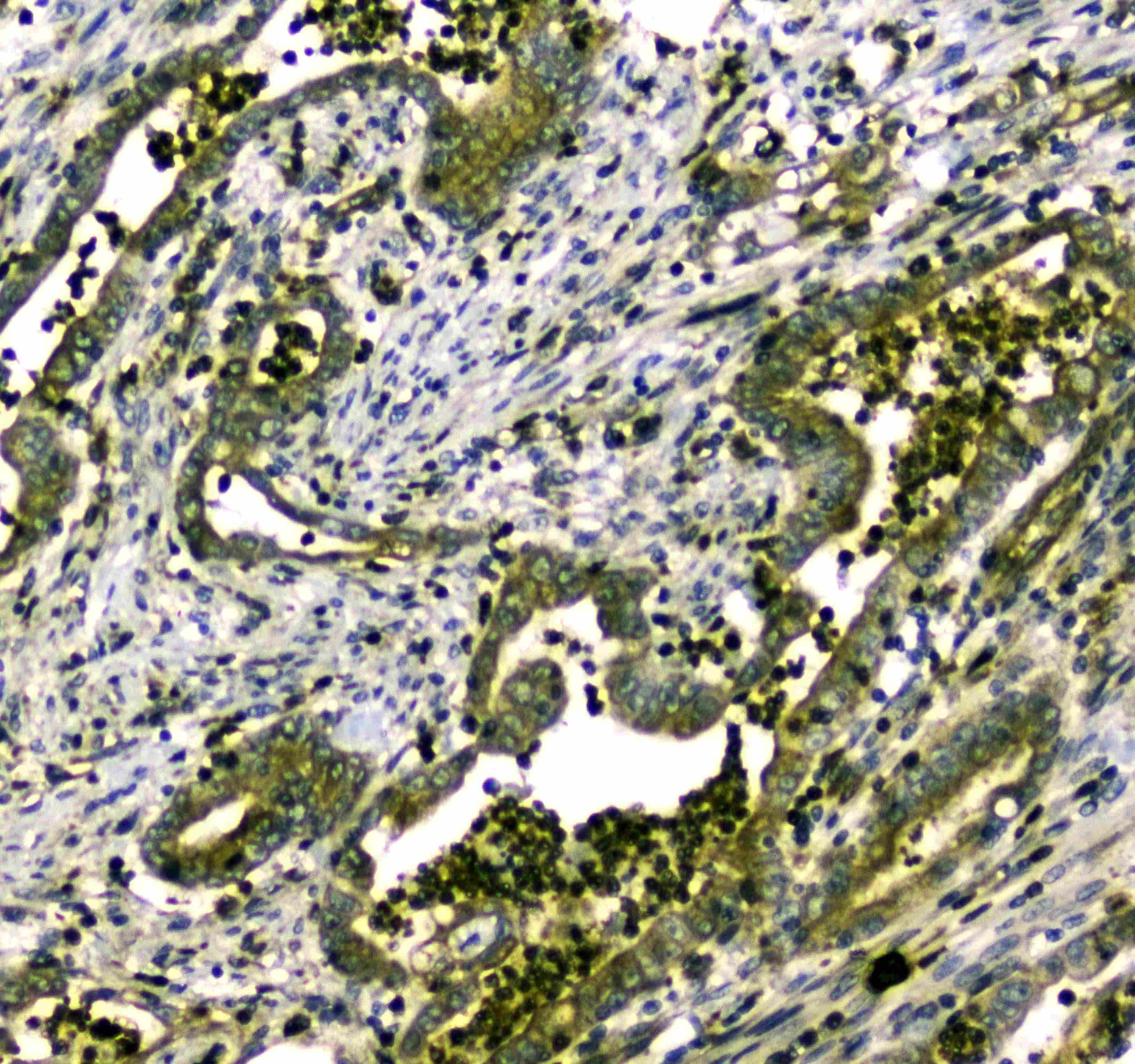 MYBPC3 / MYBP-C Antibody (aa1070-1123)