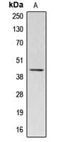 Polyclonal Rabbit anti-Human ACTBL2 Antibody (Internal, WB)