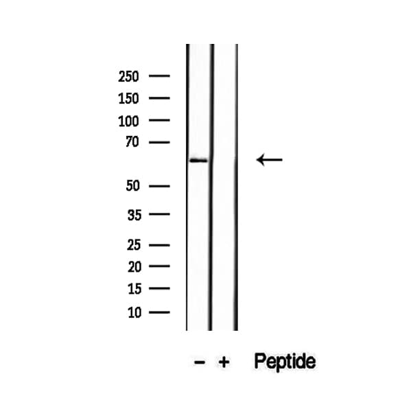 P4HA2 Antibody