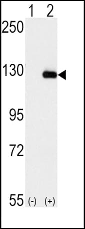 BUB1B / BubR1 Antibody (aa3-33)