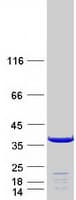 Human MAPRE3 / EB3 Protein (Recombinant Myc-DDK (Flag))