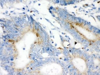 Polyclonal Rabbit anti-Human VDAC1 / PORIN Antibody (aa154-181, IHC, WB)