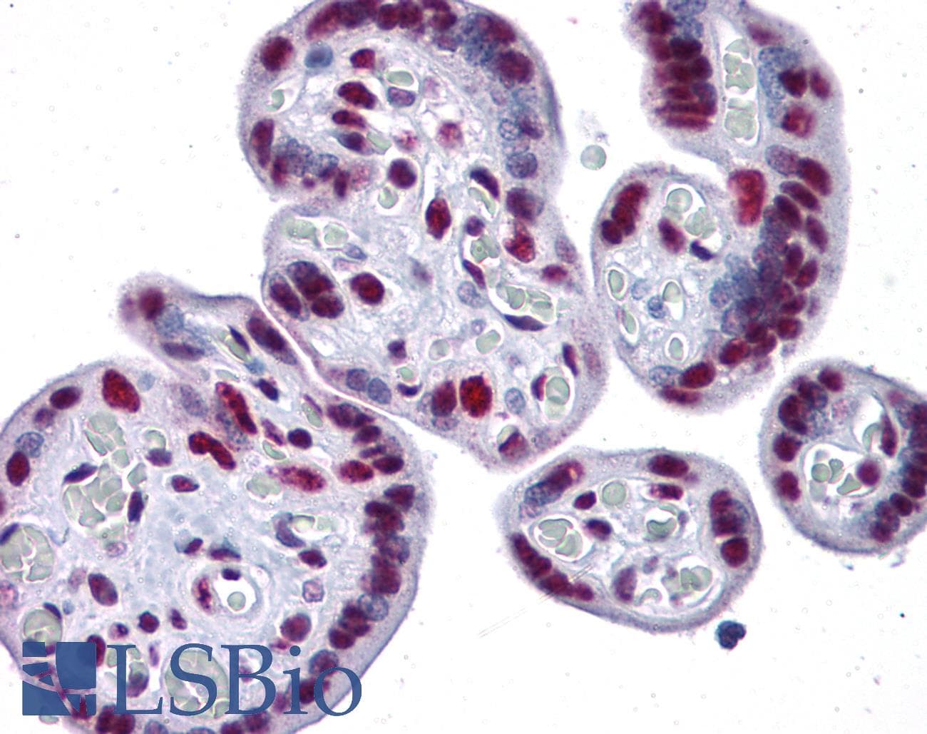 IHC-plus™ Polyclonal Rabbit anti-Human CAPN6 / Calpain 6 Antibody (IHC, IF, WB)