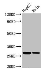 Polyclonal Rabbit anti-Human VPS29 Antibody (IHC, IF, WB)