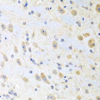 MLN / Motilin Antibody