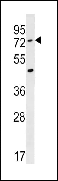 ACSM2A / MACS2 Antibody (aa41-67)