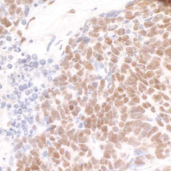 PDS5B / AS3 Antibody (aa1400-C-term)