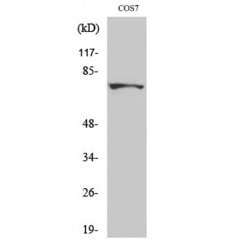 Polyclonal Rabbit anti-Human MTHFR Antibody (Internal, WB)