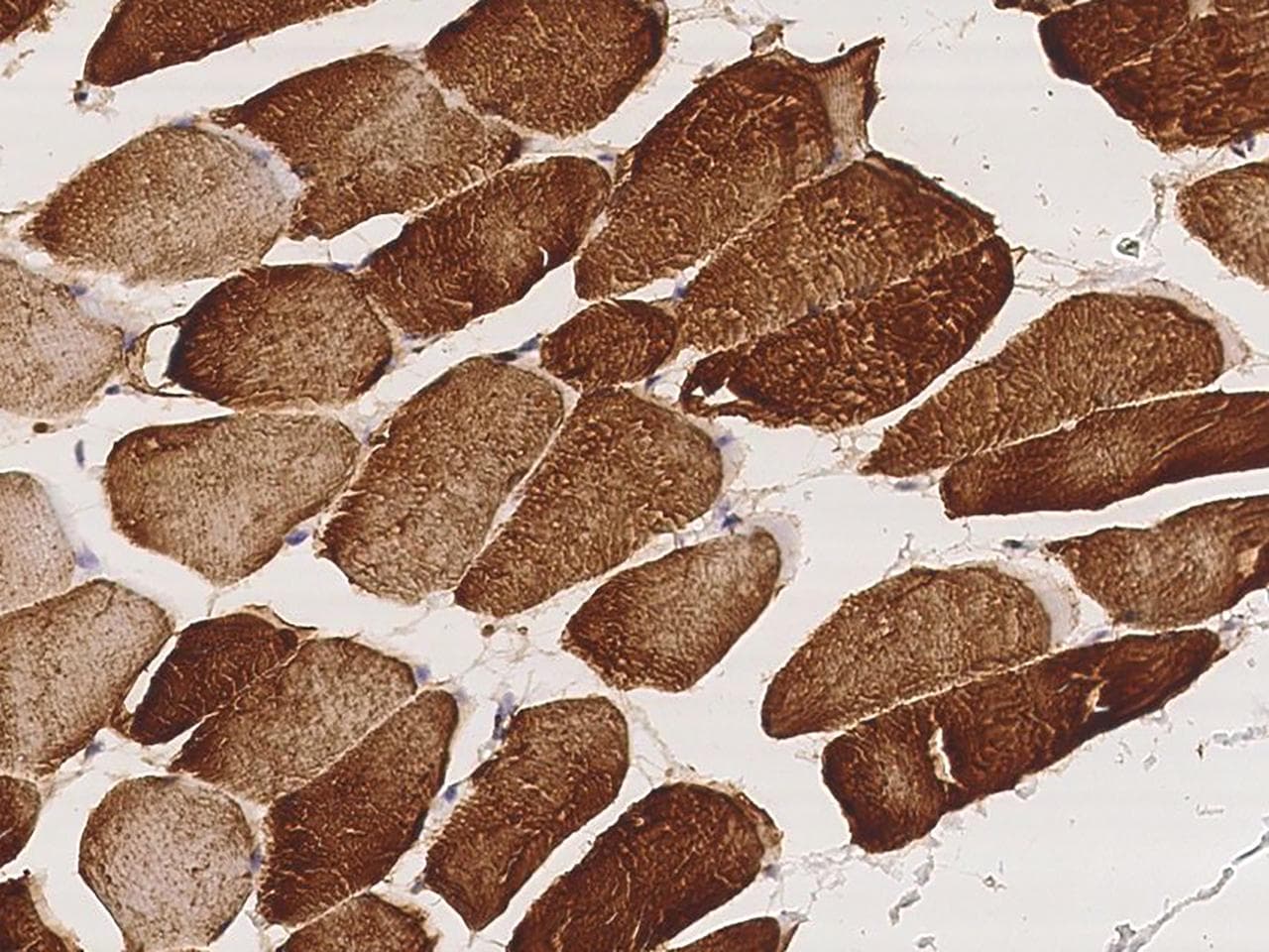 Polyclonal Rabbit anti-Human CKM / Creatine Kinase MM Antibody (IHC)