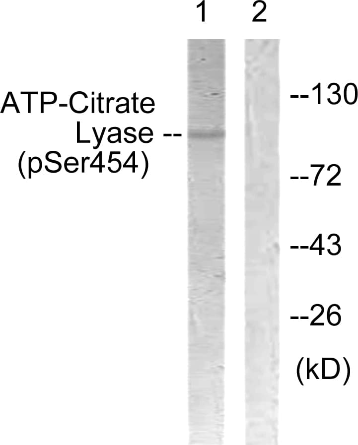 ACLY / ATP Citrate Lyase Antibody (phospho-Ser454)
