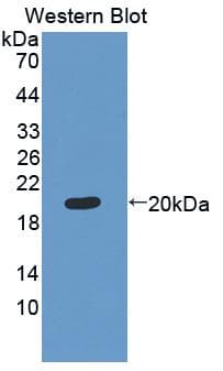 MMP13 Antibody (aa123-270, APC)