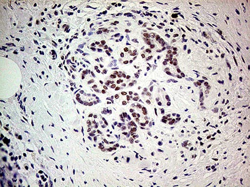 POLR2A / RNA polymerase II Antibody (aa1351-1614, clone OTI1E5)