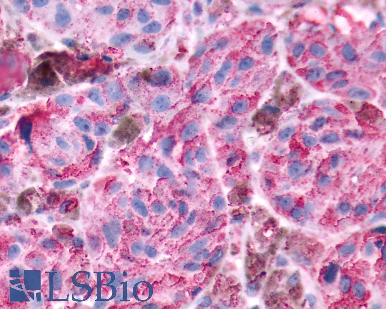 PathPlus™ GRM8 / MGLUR8 Antibody (N-Terminus)