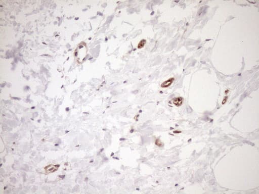 Monoclonal Mouse anti-Human ASPDH Antibody (clone OTI4G8, IHC)