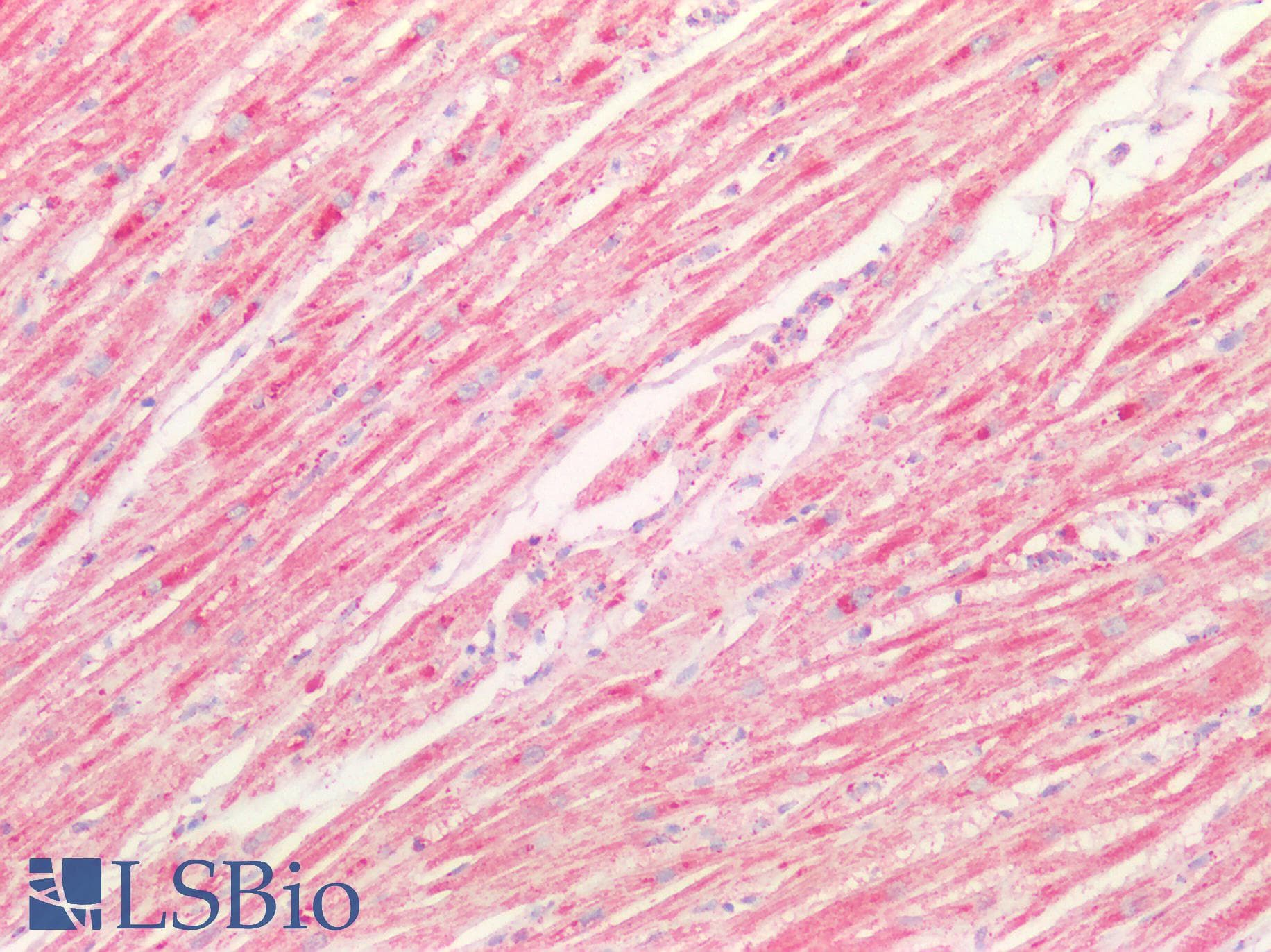 PathPlus™ SOD2 / Mn SOD Antibody (aa119-130)