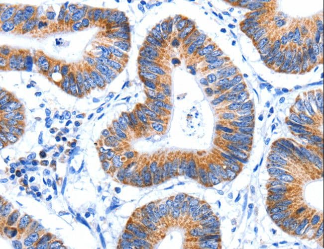 Polyclonal Rabbit anti-Human HINT2 Antibody (IHC)