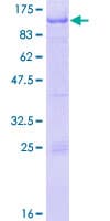 Human RFX2 Protein (Recombinant GST)