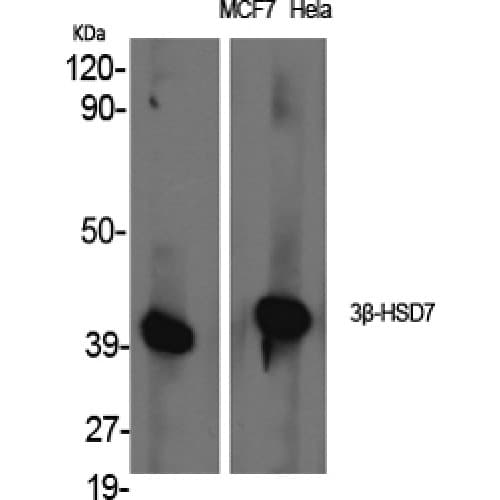 HSD3B7 Antibody (90-170 aa, Internal)
