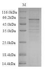 Human WNT2B Protein (Recombinant 6His-SUMO, N-terminus)