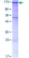 Human SEZ6L Protein (Recombinant GST)