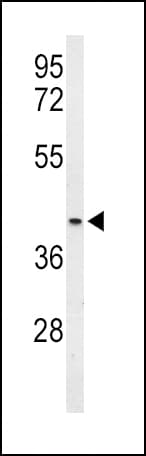 OPRM1 / Mu Opioid Receptor Antibody (aa161-187)