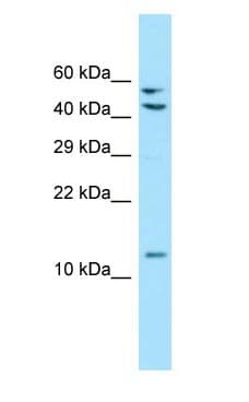 MRPL41 / PIG3 / BMRP Antibody (aa80-129)
