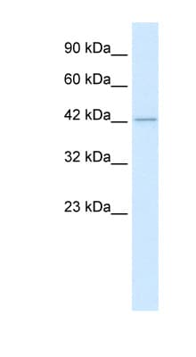 Polyclonal Rabbit anti-Human HDAC8 Antibody (C-Terminus, IHC, WB)