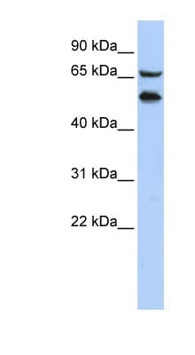Polyclonal Rabbit anti-Human TADA2L / ADA2A Antibody (C-Terminus, WB)
