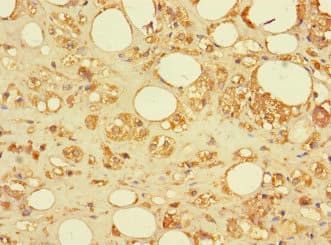 SAMD12 Antibody