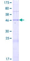 Human SAMD10 Protein (Recombinant GST)