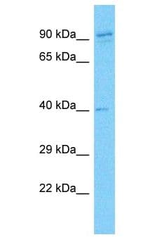 SYCP2L Antibody (aa553-602)
