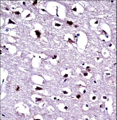 Polyclonal Rabbit anti-Human EEF1A1 Antibody (aa361-389, IHC, IF, WB)
