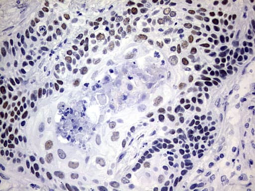 Monoclonal Mouse anti-Human NAB1 Antibody (clone OTI1D2, aa237-487, IHC, WB)