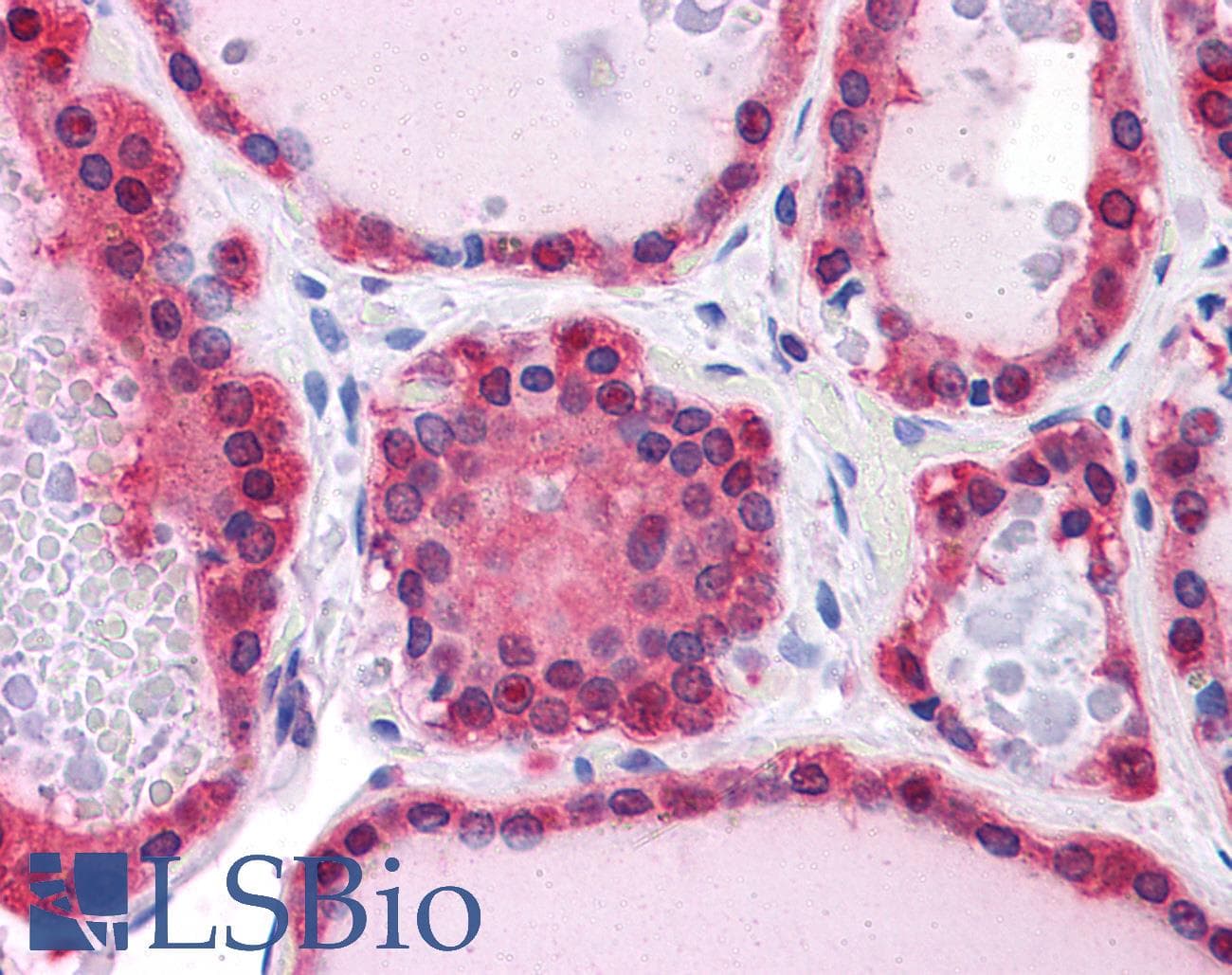 IHC-plus™ LDHB / Lactate Dehydrogenase B Antibody (clone 2H6)