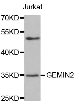 Polyclonal Rabbit anti-Human SIP1 Antibody (IHC, IF, WB)