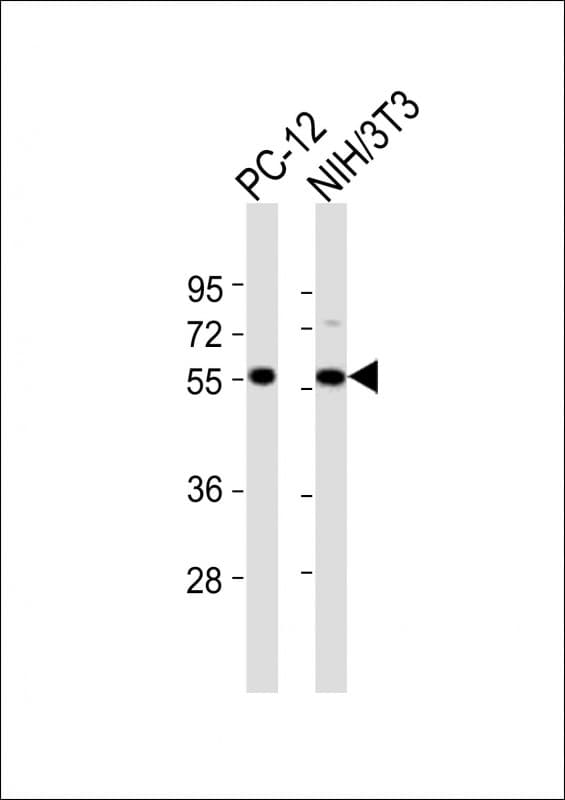 DGCR14 Antibody (aa365-398)