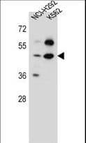 Polyclonal Rabbit anti-Human P3H4 / LEPREL4 Antibody (aa361-390, WB)