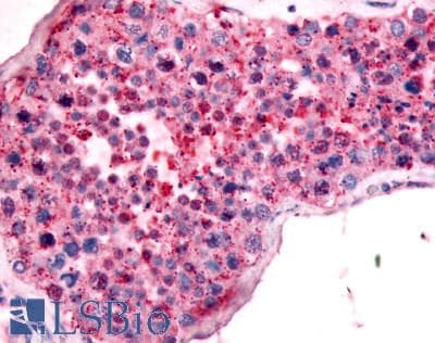 IHC-plus™ UCHL3 Antibody (C-Terminus)