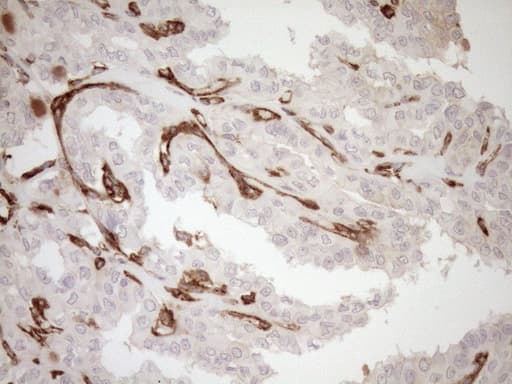 Monoclonal Mouse anti-Human ASPDH Antibody (clone OTI4G8, IHC)