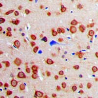 CALM1 / Calmodulin Antibody (Internal)