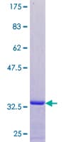 Human ATXN3 / JOS Protein (Recombinant GST)