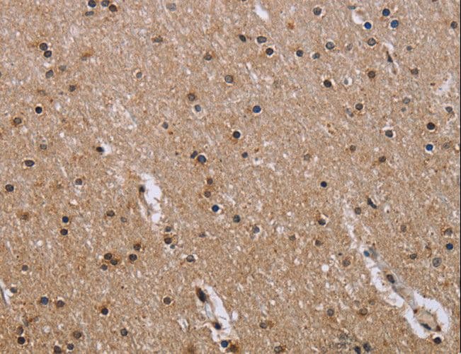 GAB2 Antibody