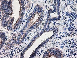 Monoclonal Mouse anti-Human CCM2 / Malcavernin Antibody (clone OTI2F9, IHC, IF, WB)