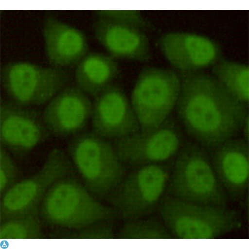 RAD23B / HR23B Antibody