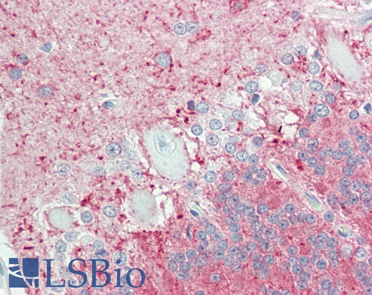 IHC-plus™ Polyclonal Rabbit anti-Human EDNRB / Endothelin B Receptor Antibody (aa409-439, IHC, IF, WB)