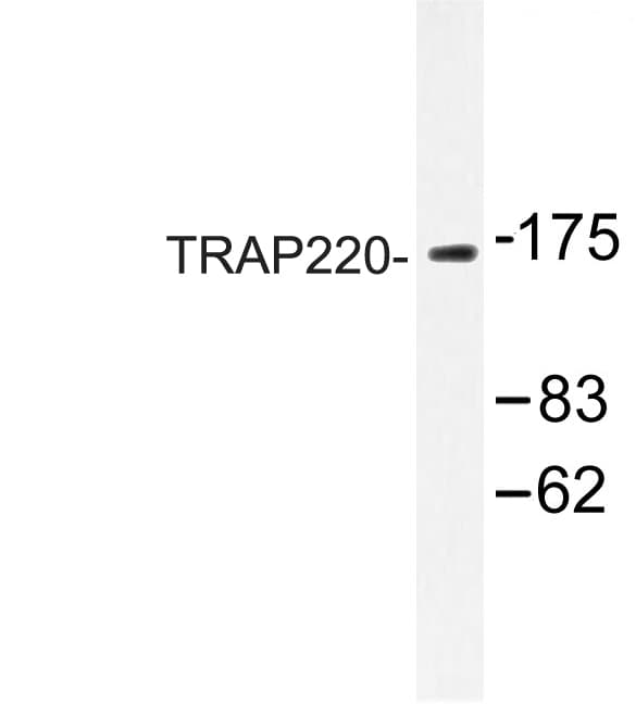 MED1 / TRAP220 Antibody (Pro697)