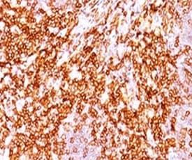 CD68 Antibody (clone LAM34-1)