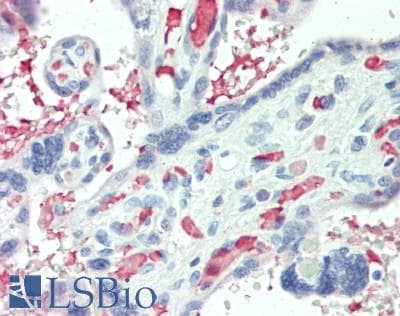 VEGFB Antibody (aa22-207)